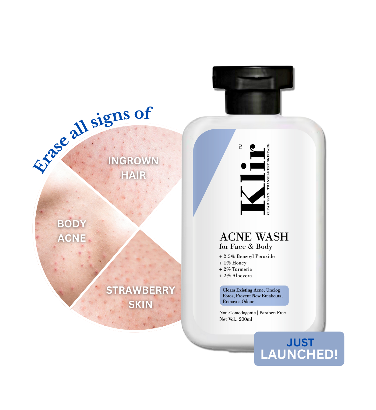 KLIR Acne Wash – Face & Body Cleanser with Benzoyl Peroxide, Aloe Vera for Acne, Odor & Oil Control – 200ml