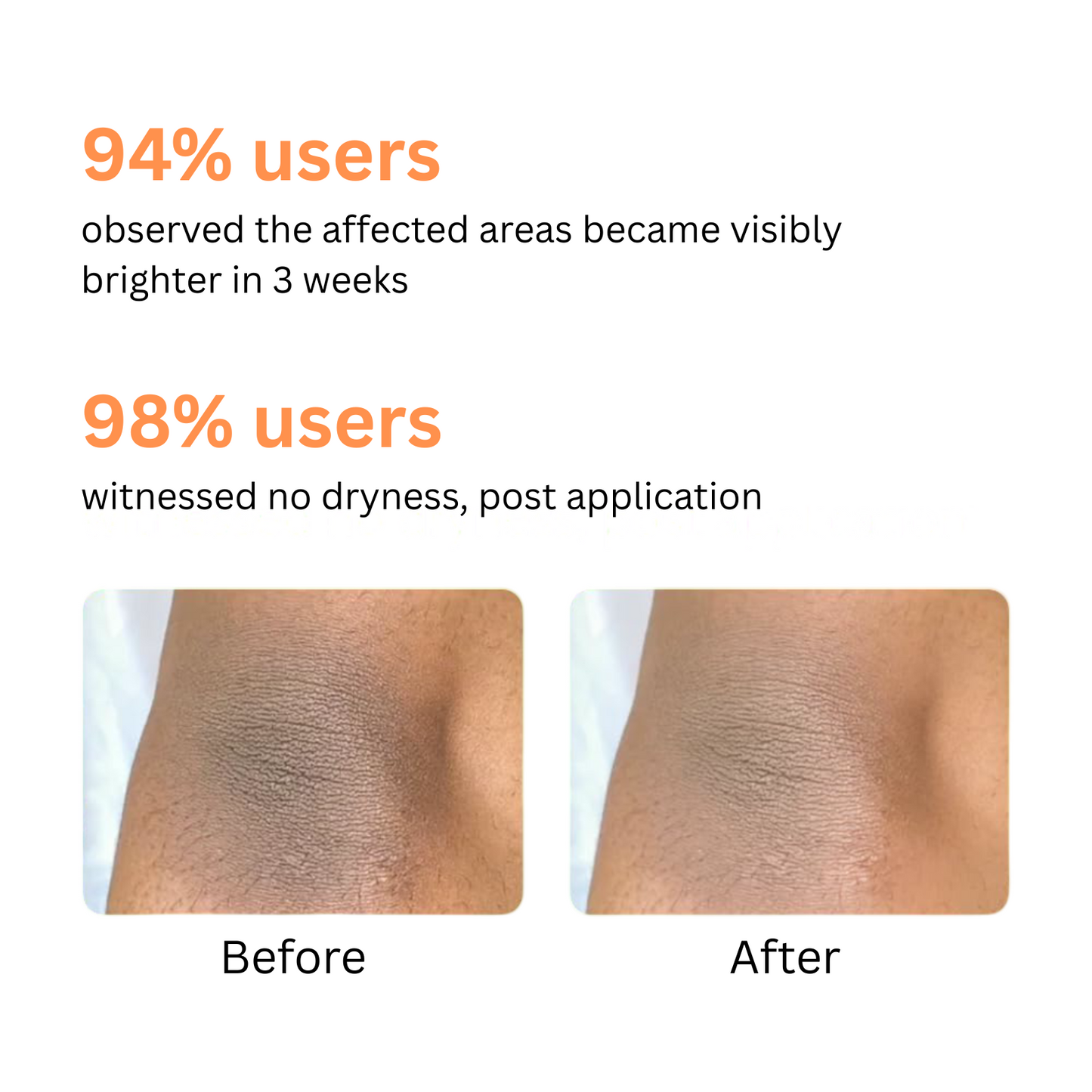 Klir BrightFix Brightening Roll On For Neck, Elbow & Knee with Kojic Acid, Glycolic Acid, Niacinamide, Licorice | Exfoliates, Removes Pigmentation | 50ml