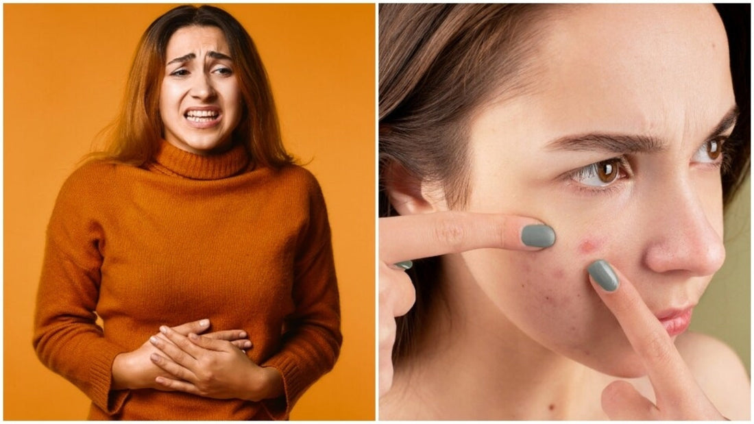 The Connection Between Gut Health and Clear Skin