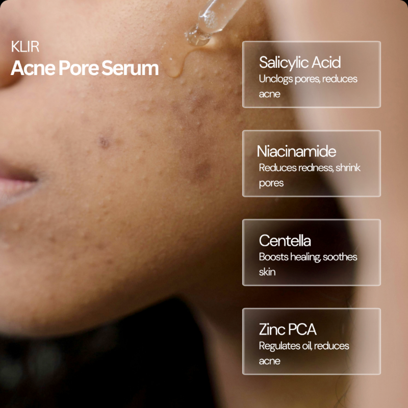 KLIR Acne Pore Serum with 2% Salicylic Acid & 2% Niacinamide  – Controls Oil, Clears Pores & Fights Acne | 30ml